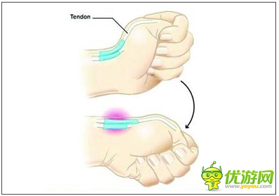 玩手機易患十大“智能手機病” 這些癥狀你都有嗎？